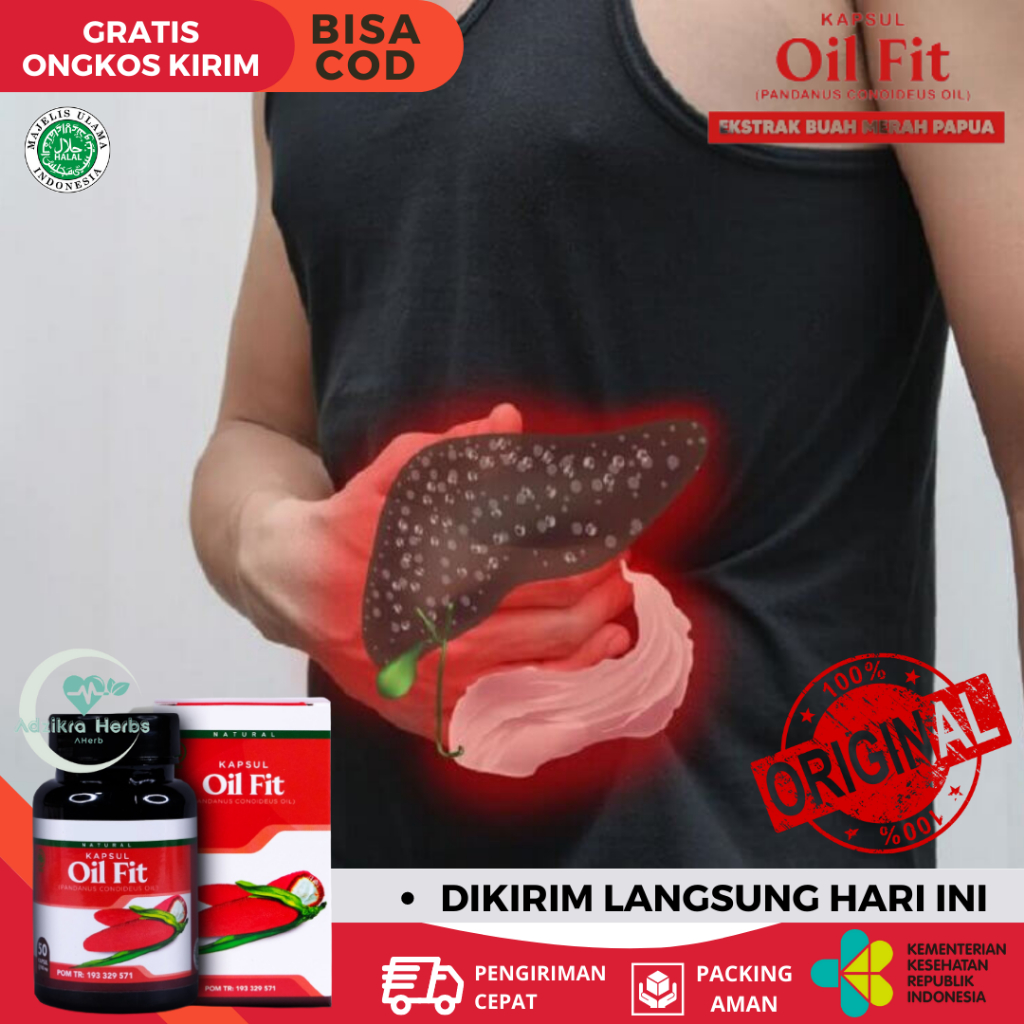 Obat Batu Empedu, Obat Penghancur Batu Empedu, Obat Radang Empedu, Obat Infeksi Empedu,Obat Batu Emp