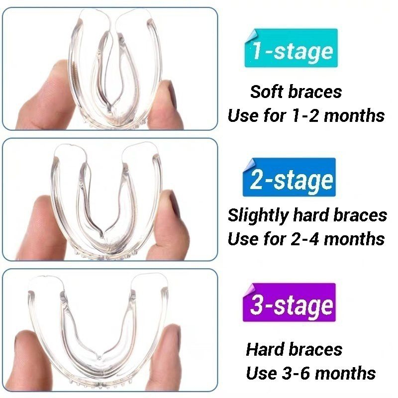 ORIGINAL VASDEN Alat perapi Gigi Clear Aligner Teeth Braces 3 Stage Hard