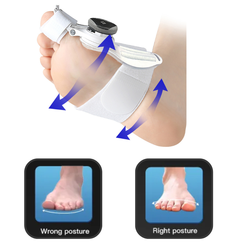 ALAT KOREKTOR PELURUS PENYANGGA TULANG JEMPOL JARI KAKI BUNION HALLUS VALGUS - Splint Big Toe Straightener Corrector Adjustable Knob