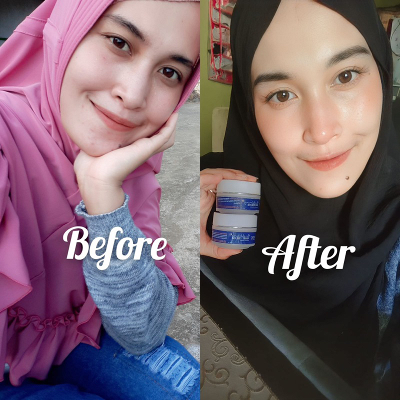paket skincare basic zaida glow asli 1000% OrIgInaL