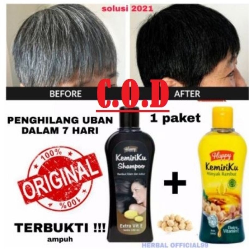 [PAKET HEMAT] HAPPY KEMIRIKU Shampoo + Minyak Penghilang Uban 100% Original Halal+BPOM - Shampoo+Minyak Rambut (100ml+100ml) - Penumbuh Rambut Botak - Perawatan Rambut Rusak Bercabang
