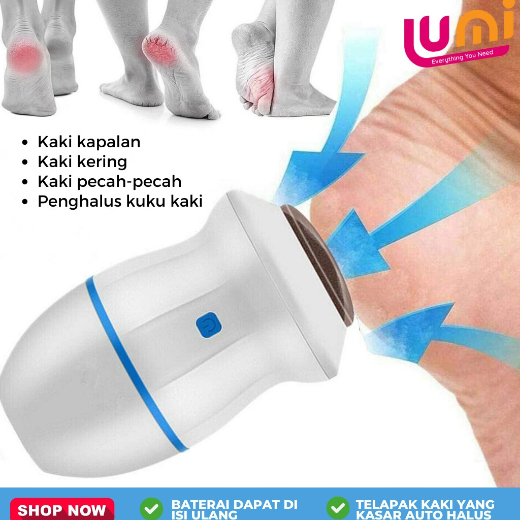 Alat Penghalus Tumit Kaki Perawatan Kulit Kapalan Foot Pedicure Elektrik Otomatis