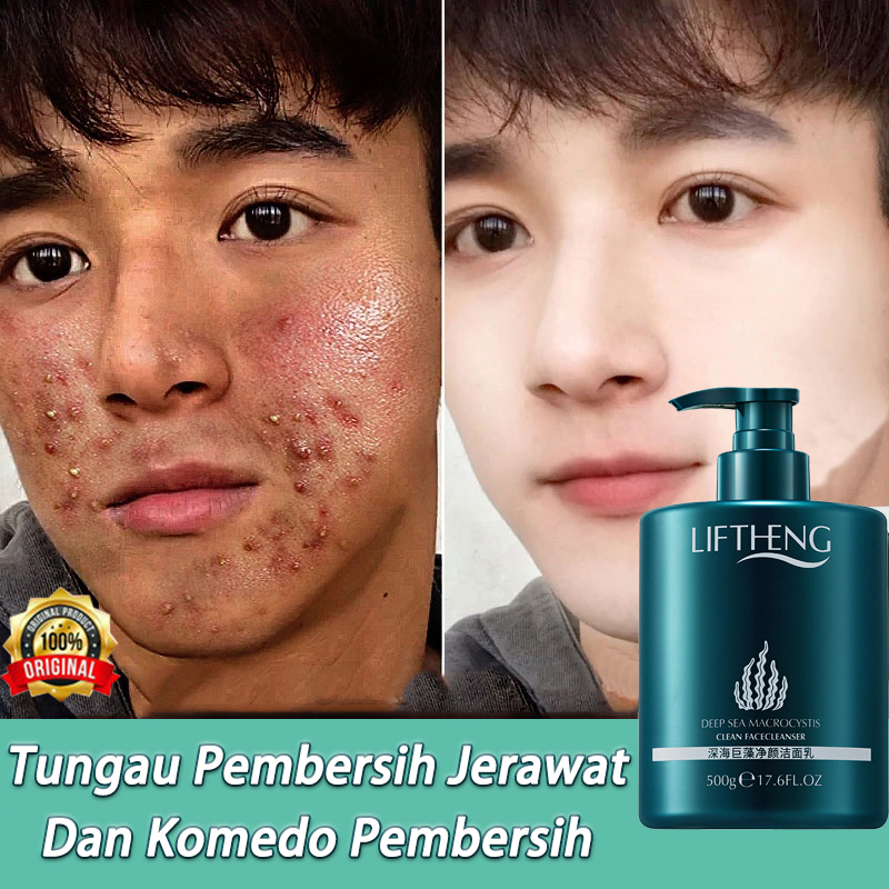 Pembersih Wajah pembersih jerawat sabun pembersih wajah 500ml Jerawat Pembersih Susu Kontrol Minyak Pemutih Wajah Pelembab Moisturizing