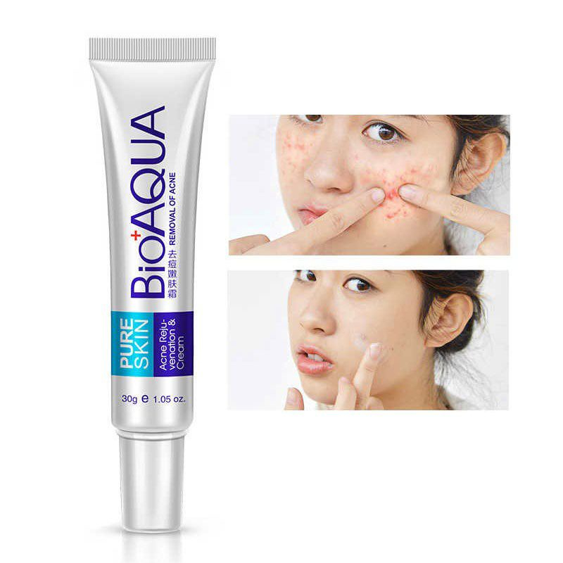 [ ORIGINAL ] OBAT JERAWAT DAN BEKAS JERAWAT AMPUH PURE SKIN REMOVE OF ACNE