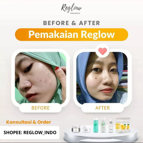 Reglow 2pcs Set Night Cream + Toner Micellarwater dr Shindy Skincare Ori Official Store