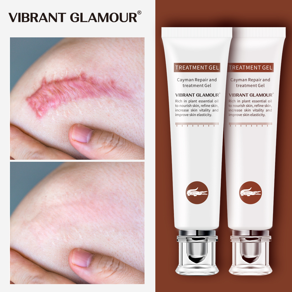 Vibrant Glamour Cayman Repair and Treatment Gel Penghilang Bekas Luka 20g