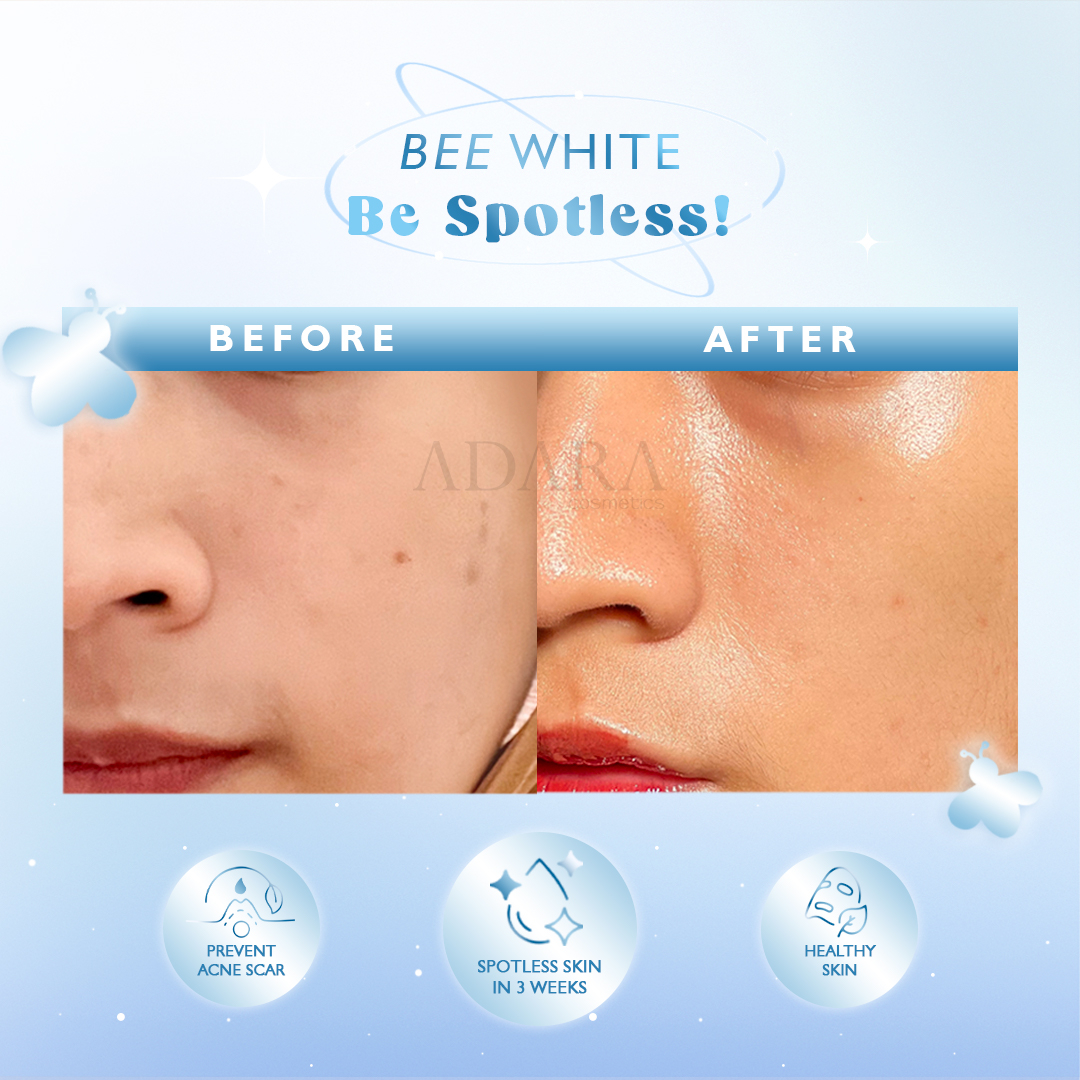 ADARA - BEE WHITE SPOTLESS GEL