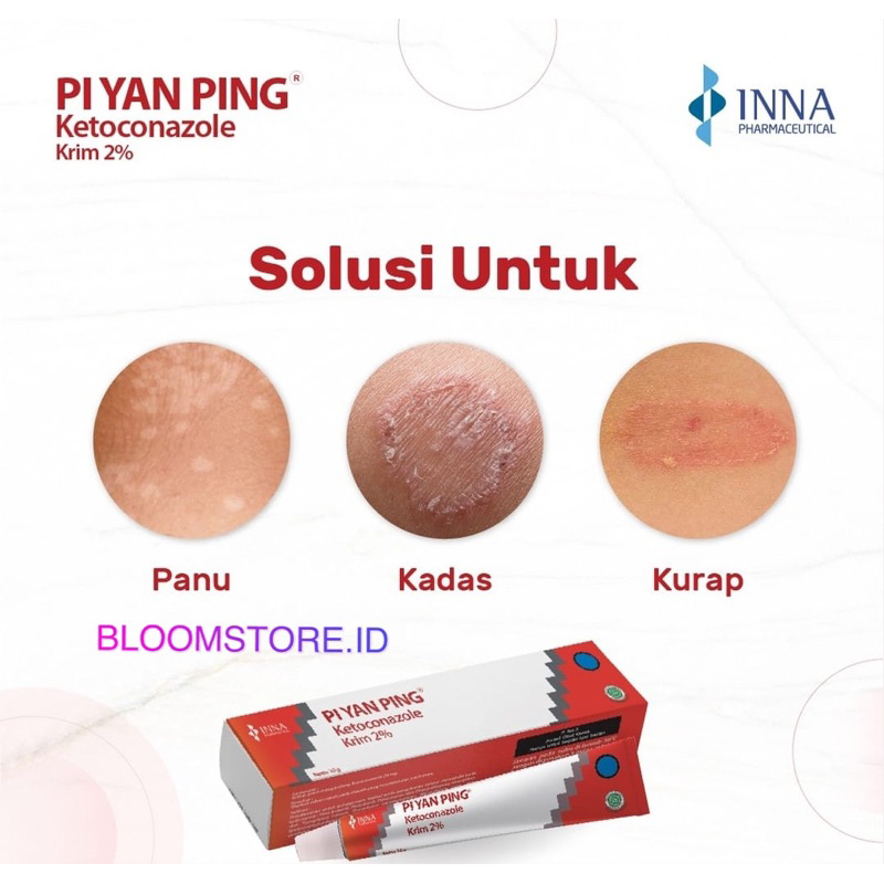 PI YAN PING Obat Salep Krim Krem Cream Ketoconazole 2% Jamur Panu Kadas Kurap 10 g gr gram 10g 10gr 10gram Kaki Pecah-Pecah Piyanping Piyan Ping Original Efektif Asli Dewasa Anak Kecil Bayi