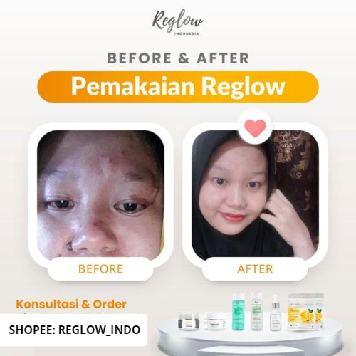 PAKET JERAWAT Reglow Skincare Original dr. Shindy Original Cream Acne Facial Wash Toner Produk Kosmetik 100% Ori Rglow Official Store