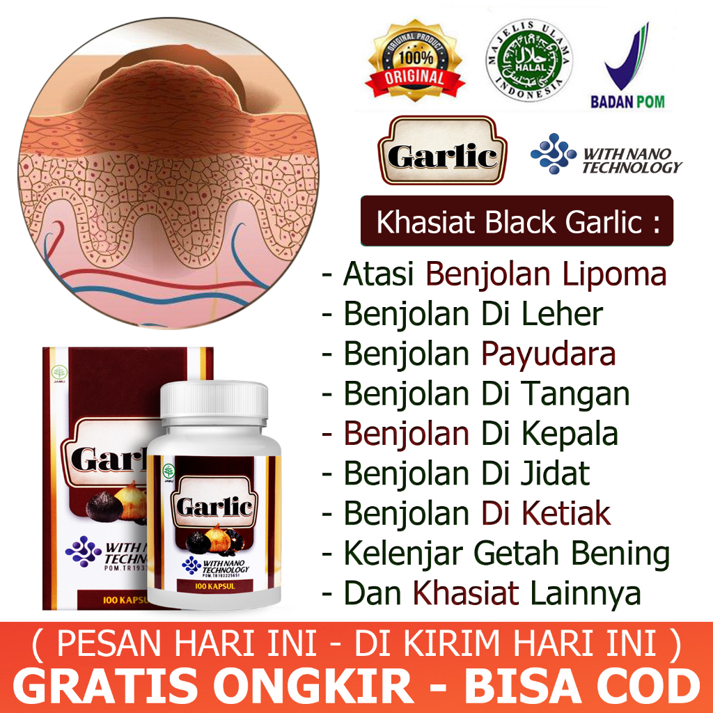 Walatra Black Garlic Obat Benjolan Lipoma Leher Kelenjar Getah Bening Pengempis Benjolan Di Payudara