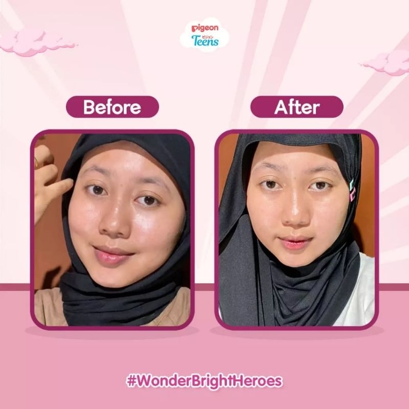 PIGEON TEENS Acne Ranger Serum Untuk Jerawat Dan Flek Hitam / Bright Heroes Serum Untuk Kulit Kusam / Hydra Squad Serum Untuk Kulit Kering