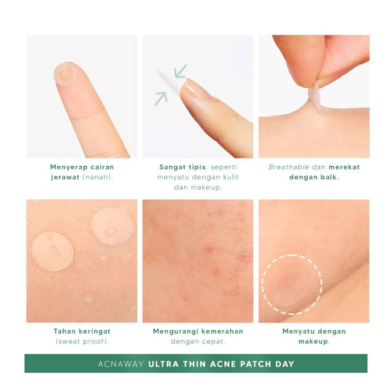 ❤️ MEMEY ❤️ ACNAWAY Acne Patch | Ultra Thin | Infinity-Size