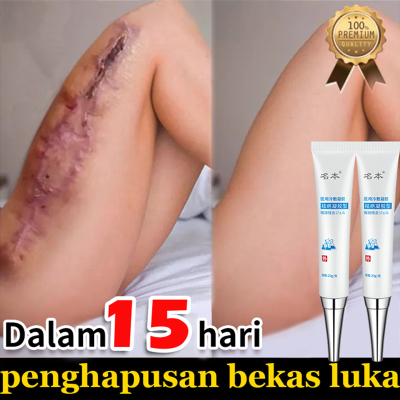 Gel menghilangkan bekas luka krim memudarkan bekas luka memperbaiki jerawat bekas luka lama bekas luka stretch mark bekas luka bakar 20g