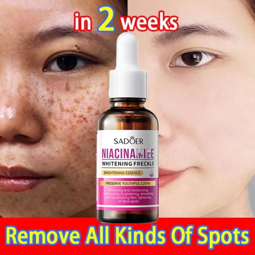 SADOER 30ml Niacinamide Whitening Spot Removal  Freckle Serum Dull Black Melanin Melasma Remover