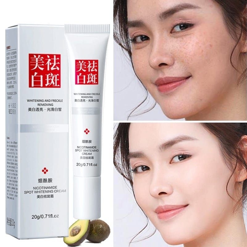 Whitening Freckle Cream Penghilang flek dan Bintik