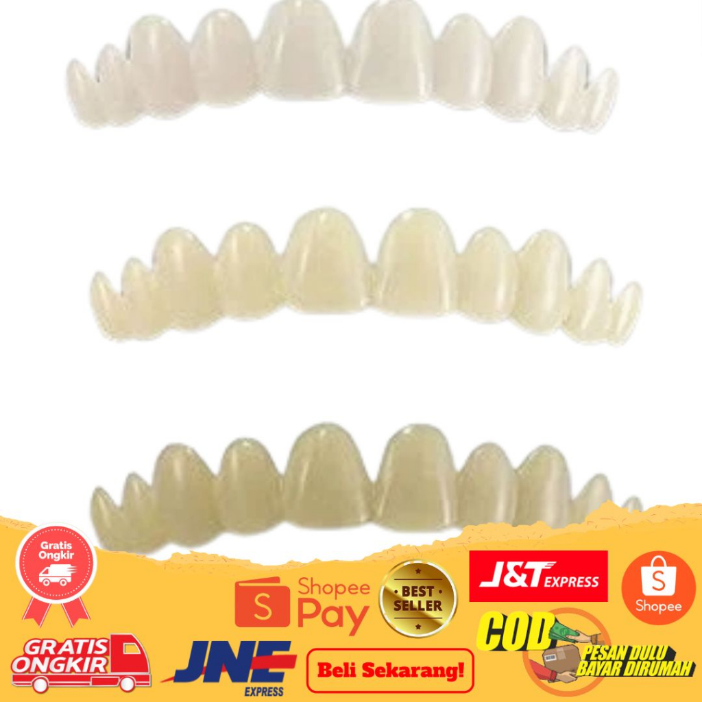 Gigi Palsu Veneer White | Not Snap On Smile | Perapih Gigi Vener White Original | Gigi Bolong | Gigi Patah | Gigi Kuning | Gigi Rusak COD Gigi Palsu Snap On Smile Venner White Gigi Palsu Terlaris