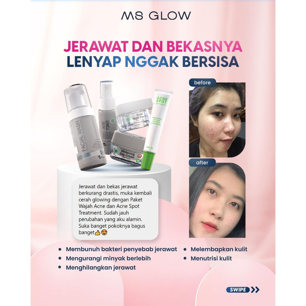 PAKET ACNE FREE ACNE SPOT TERBARU PROMO BUNDLING