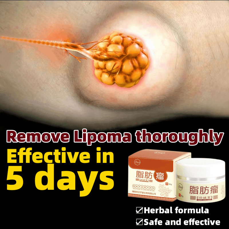 Obat Benjolan Lipoma Krim lipoma OBAT OLES PENGHILANG BENJOLAN LIPOMA 30g
