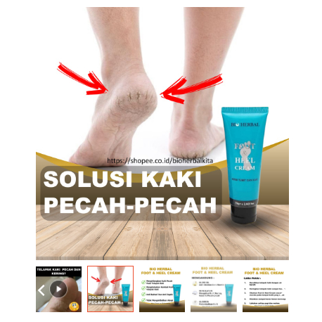 Obat Kaki Pecah Dan Kering Ampuh Krim Masker  KAKI