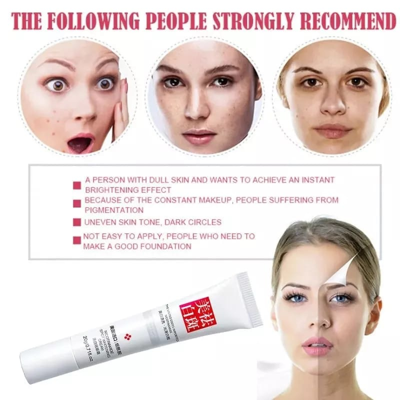 ANDORHEAL WHITENING FRECKLE CREAM REMOVE DARK SPOTS REMOVING