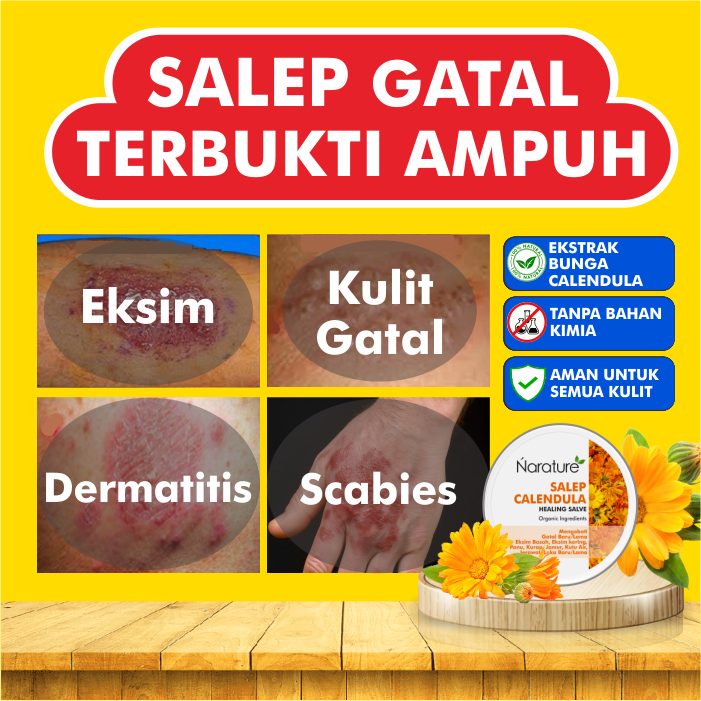 Salep Obat Gatal Calendula Salve Paling Ampuh Gatel Kulit Kutu Air Scabies Psoriasis Kurap Kudis Eks