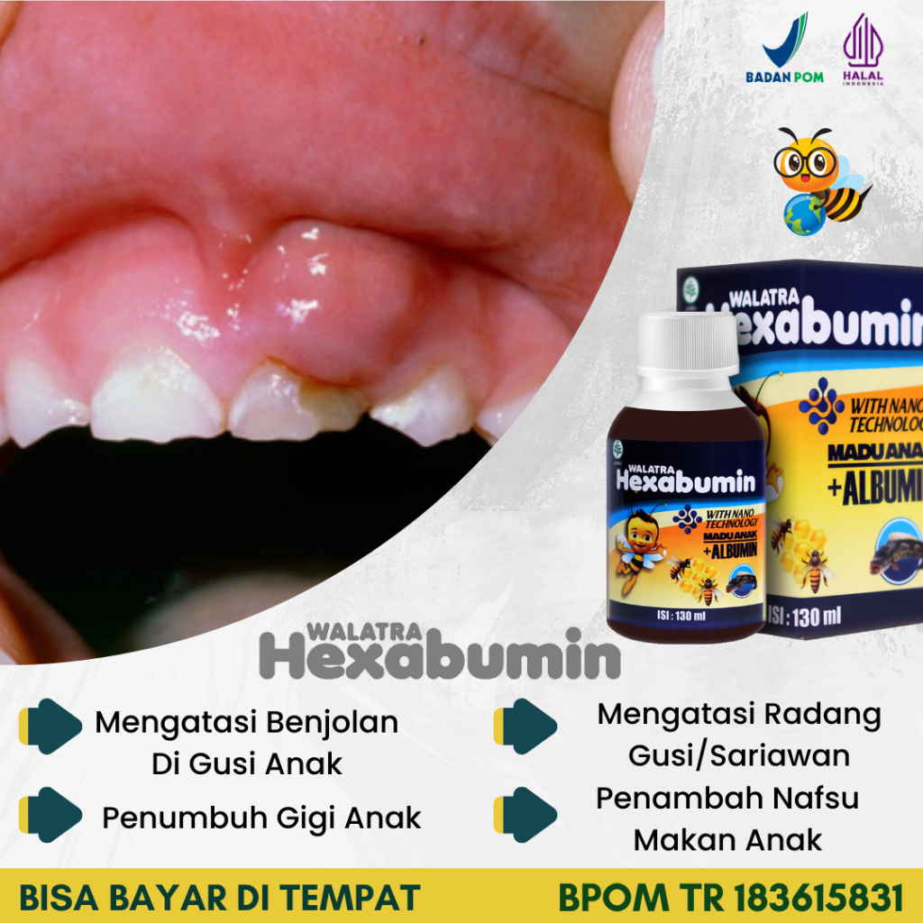 

Hexabumin Madu Anak Obat Benjolan Di Gusi Radang Bengkak Lecet Luka Berdarah Bernanah Sariawan Perih Penumbuh Gigi Untuk Anak Bayi Percepat Tumbuh Gigi Ompong Berlubang Lidah Putih Kandidiasis Oral Sariawan Di Lidah Panas Dalam Gangguan Pencernaan