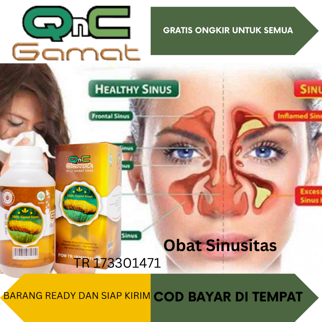 Obat Sinusitas Infeksi Radang Sinusitas Obat Sinus Paranasal Filek Menahun Polip Hidung Saluran Pern