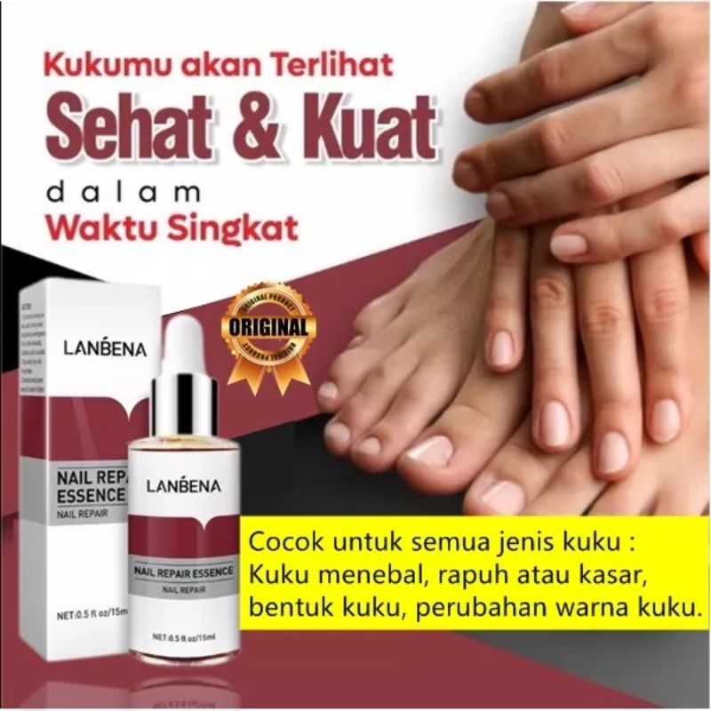 LANBENA NAIL REPAIR ESSENCE Obat Jamur kuku onikomikosis Obat Kuku Rusak krim PERAWATAN KUKU