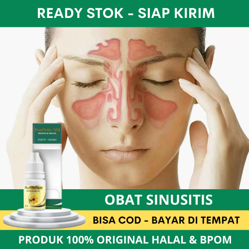 Obat Hidung Sinusitis Menahun, Sinusitis Terbukti, Hidung Tersumbat, Pilek Menahun, Hidung Tidak Bis