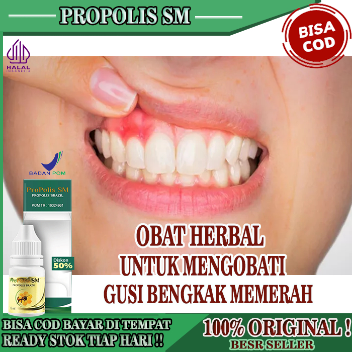 Obat Gusi Bengkak , Obat Sakit Gusi, Obat Gusi Bengkak Dan Sakit Gigi, Obat Gusi Bengkak Bernanah, O