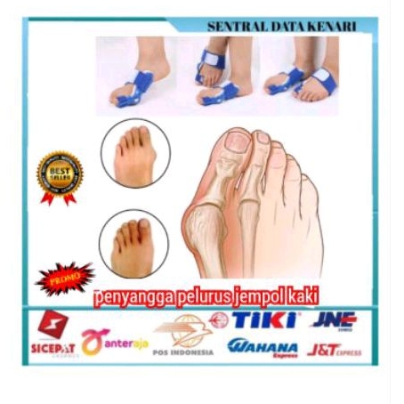 BUNION THERAPY BUNION CORECTOR BUNION ROBOT HALUX VALGUS