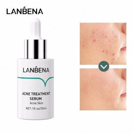 LANBENA Acne Treatment Serum Acne Essence Serum Wajah Perawatan Wajah Melembabkan Oil Control Repair