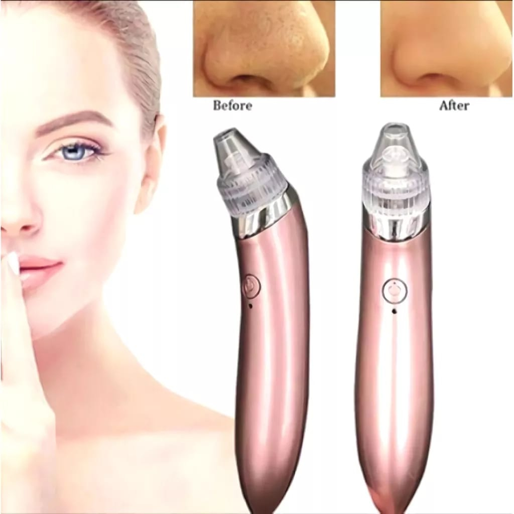 Alat Penyedot Sedot Komedo Vakum Komedo XN-8030