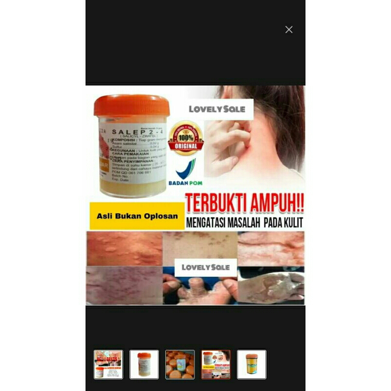 salep gatal selengkangan zwafel