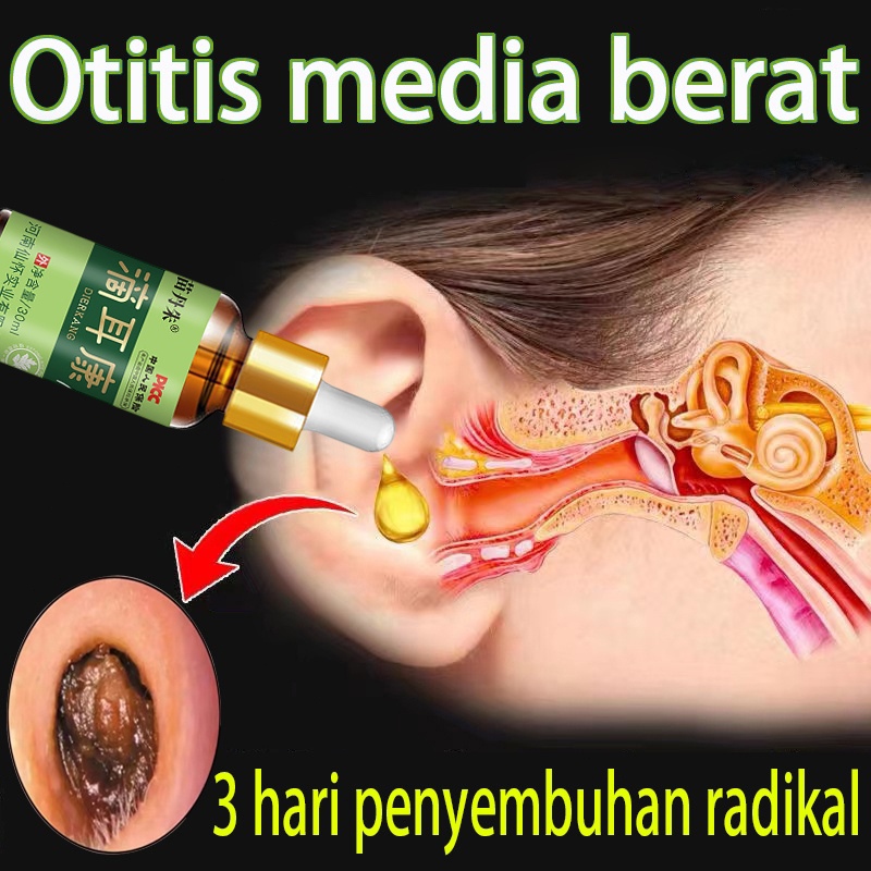 【100% Original】Obat Paling Ampuh Telinga Bernanah Obat Telinga Sakit 30ML Obat Tetes Telinga Bernana
