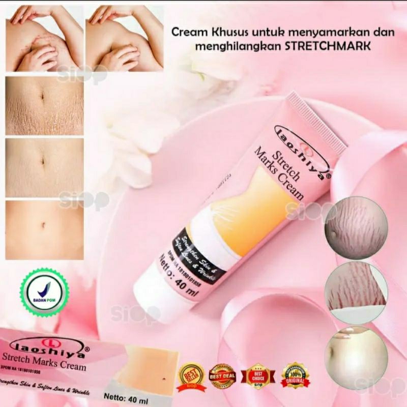 CREAM STRETCH MARK LAOSHIYA