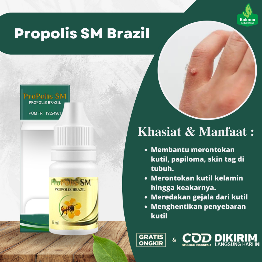 Obat Penghilang Kutil Di Jari Tangan, Kutil Di Telapak Tangan, Kutil Di Siku, Kutil Di Kaki