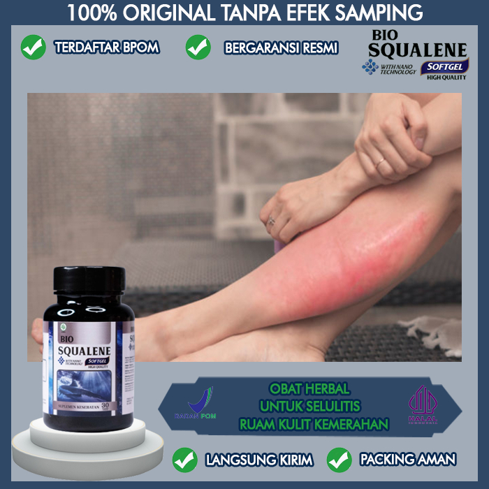 Obat Untuk Selulitis Ruam Kulit Kemerahan, Obat Selulitis Di Kaki, Obat Selulitis Ruam Scabies Gatal