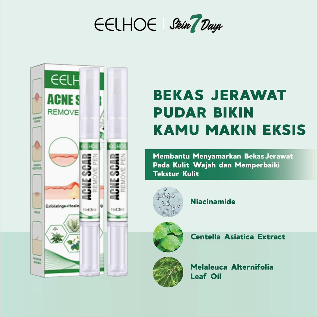 【ORIGINAL】Krim anti jerawat krim jerawat salep jerawat cream jerawat 2 instalasi gel anti jerawat Herbal Essence Menghilangkan Jerawat Memperbaiki Kulit Dengan Cepat Menghilangkan Jerawat Pria dan Wanita