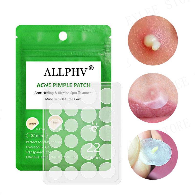 [Ori100%]Allphv Acne Patch Pimple Removal Penghilang Jerawat Day Use 0.1mm and Night Use 0.3mm Acne Treatment Ready Stock(22 sticker jerawat)