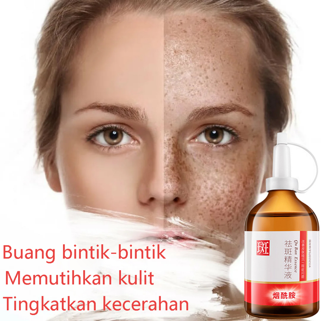 Dark Spot Serum Brightening Serum Anti Freckle Cream Krim Penghilang flek 100ml ORI HALAL CREAM DOKTER PEMUTIH Remove Penghilang Flek/Bintik Noda Hitam Komedo