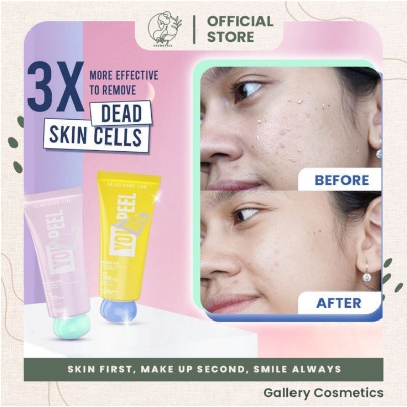 MADAME GIE YOU PEEL ME PEELING GEL| PEELING MADAME GIE murah