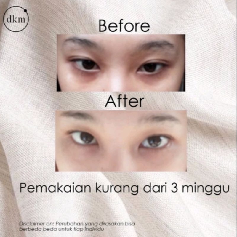 DKM EYE SERUM - PENGHILANG KANTUNG MATA DAN MATA PANDA