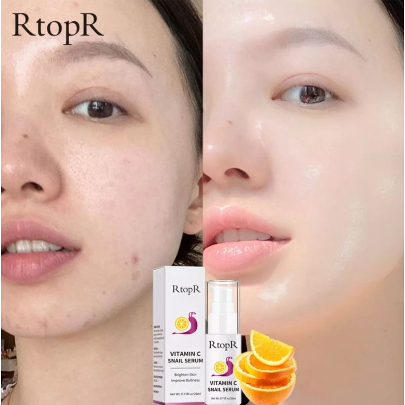 RTOPR VITAMIN C SERUM SNAIL BRIGHTENING FADE DARK SPOT LIGHTENING SERUM BRIGHTENING SKIN SERUM BEKICOT ANTI