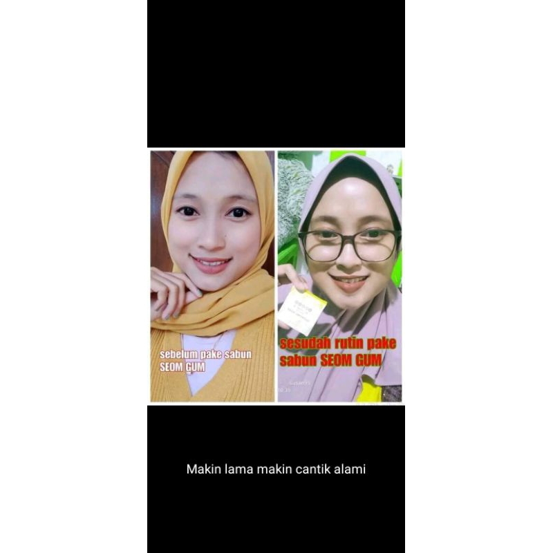 

SEOM GUM