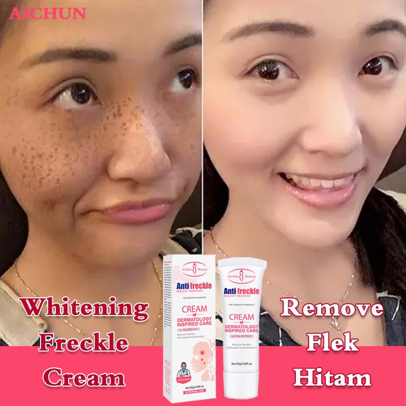 AICHUN Whitening Freckle Cream Remover Dark Spot Untuk Pelembab Wajah Mencerahkan kulit Penghilang Flek Hitam/Jerawat/Bintik Noda Hitam Komedo-20Gr