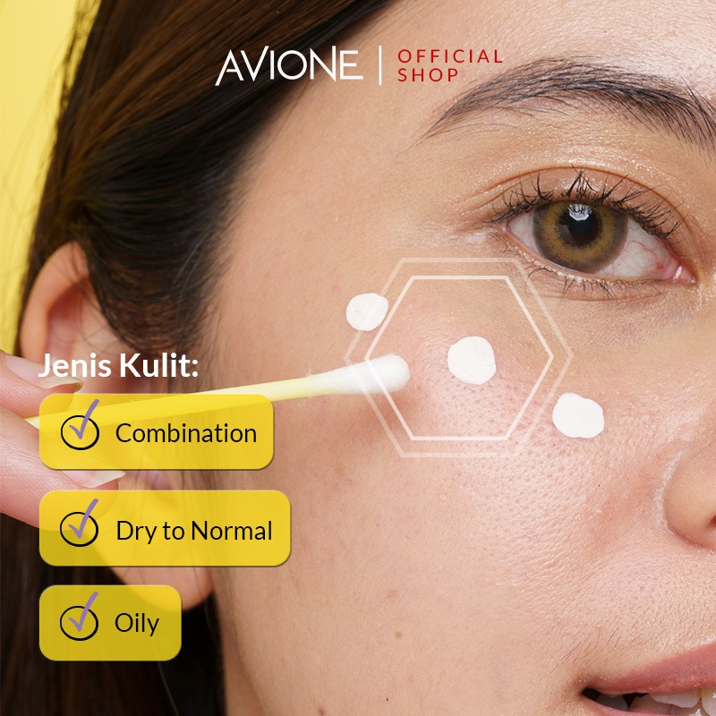 AVIONE Royale Acne Care Dry Lotion - Obat Jerawat