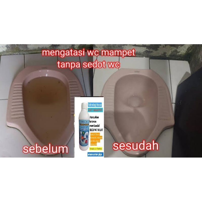 SEGAERO FASTAPON ANTI SUMBAT Obat Cairan Anti Sumbat Cara Mengatasi Mampet  Wc Saluran Air Wastafel Mampet Yang Bekerja Super Cepat Talang Mampet Sumbat Terbukti Ampuh Atasi Mampet Cara Atasi Septic Tank Penuh WC penuh Mampet Sumbat TEKNOLOGI KOREA