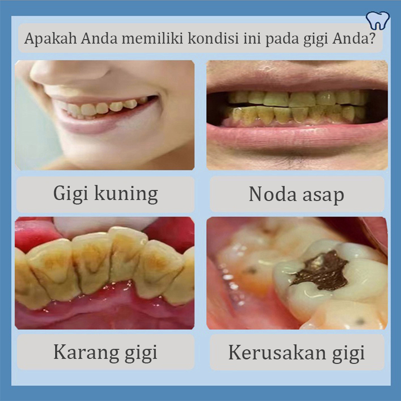 Odol pemutih gigi dan karang gigi Permanen teeth whitening Bubuk pemutih gigi 50G Pemutih gigi dan penghilang karang gigi Pasta gigi pemutih Perawatan Pemutihan Gigi/Menghilangkan Gigi Kuning/Noda Teh