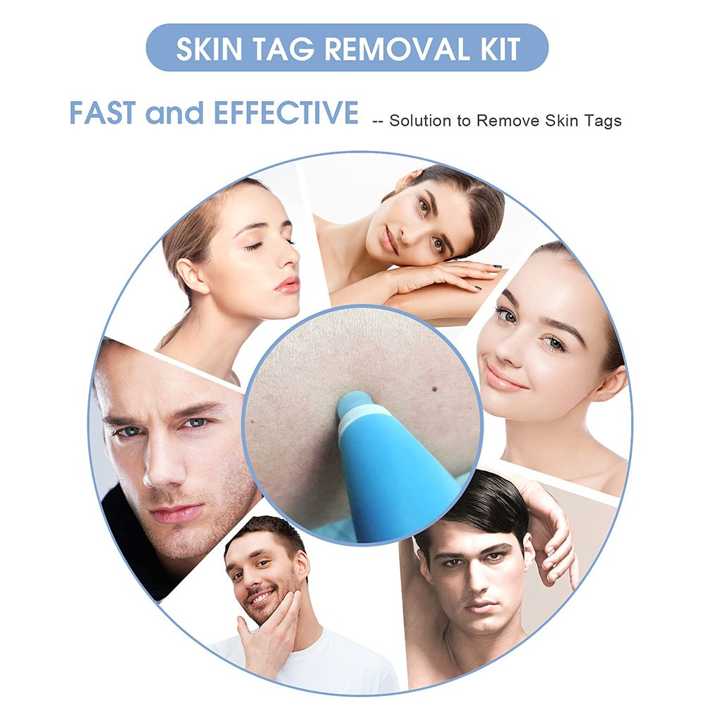 MAANGE Kit Penghilang Tag Kulit 2 in 1 Otomatis Perangkat Penghilang Tag Kulit Mikro Penghapus Kutil Noda Tahi Lalat Dewasa Set Perawatan Wajah Pena Perawatan Kulit Skin Tag Mole Removal Kit 1333